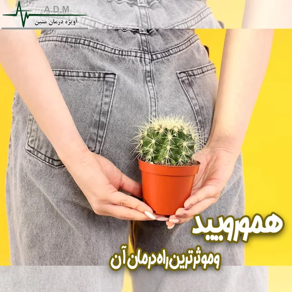 همورویید-آویژه درمان متین