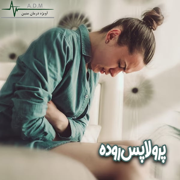 پرولاپس روده-آویژه درمان متین