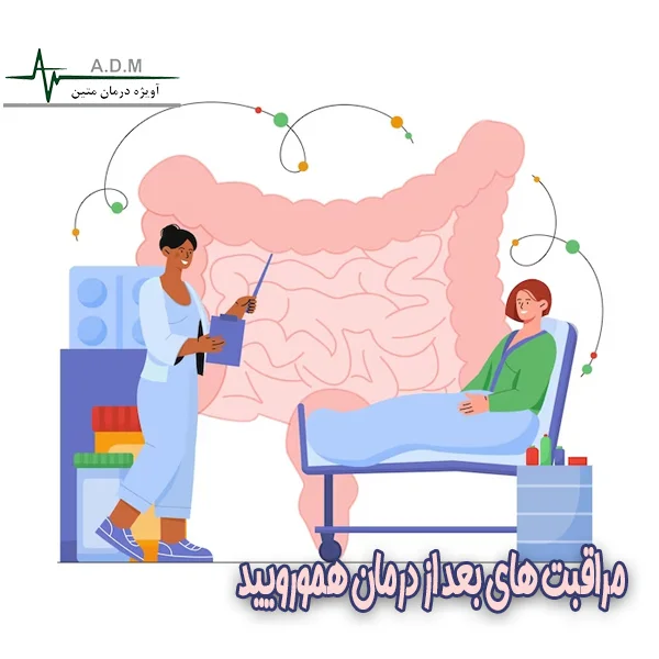 مراقبت های بعد از درمان هموروئید-آویژه درمان متین